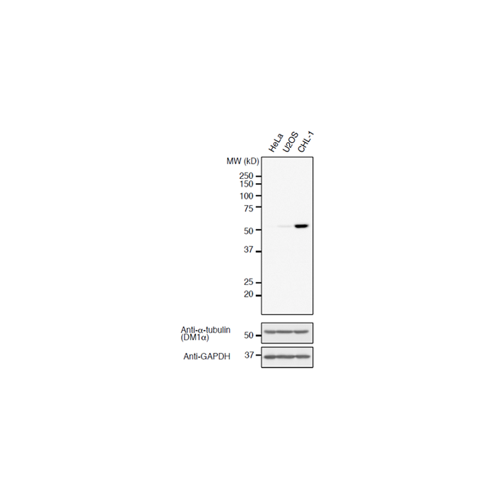 anti-Detyrosinated α-Tubulin (human), Rabbit Monoclonal