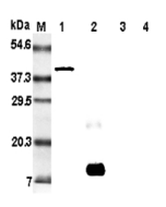 Western blot analysis of resistin using anti-Resistin (rat), mAb (RRES 07) (Prod. No. AG-20A-0015)  at 1:5'000 dilution. <br />1: Rat resistin:Fc fusion protein.<br />2: Recombinant rat resistin protein (His-tagged).<br />3: Recombinant human resistin pro