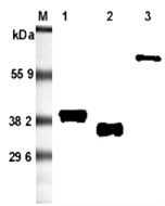 Western blot analysis using anti-Adiponectin (rat), mAb (RADI 264) (Prod. No. AG-20A-0036) at 1:5'000 dilution.<br />1: Rat adiponectin (FLAG<sup>®</sup>-tagged).<br />2: Recombinant rat adiponectin (His-tagged).<br />3: Rat adiponectin Fc-fusion protein.