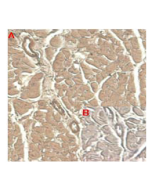 Immunohistochemical staining of human tissue using anti-IL-33 (human), mAb (IL33305B) (Prod. No. AG-20A-0041) at 1:100 dilution.<br />A. Immunoperoxidase staining (cytoplasmic) of formalin-fixed, paraffin-embedded human heart (100x, brown colour).<br />B.