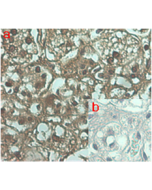Immunohistochemical staining of human tissue using anti-ANGPTL7 (human), mAb (Kairos 108-4) (Prod. No. AG-20A-0053) at 1:100 dilution. <br />A. Immunoperoxidase staining (cytoplasmic) of formalin-fixed, paraffin-embedded human adrenal gland (200x, brown c