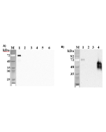 Western blot analysis using anti-DLK1 (mouse), mAb (PF105B) (Prod. No. AG-20A-0057) at 1:2'000 dilution.<br />A)<br />1: Mouse DLK1 Fc-protein.<br />2: Human DLK1 Fc-protein.<br />3: Mouse DLL1 Fc-protein.<br />4: Mouse DLL4 Fc protein.<br />5: Mouse Jagg
