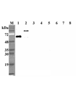 Western blot analysis using anti-DLL1 (human), mAb (D1L165-6) (Prod. No. AG-20A-0074) at 1:2'000 dilution.<br />1: Human DLL1 (FLAG<sup>®</sup>-tagged).<br />2: Human DLL1 Fc-protein.<br />3: Human DLL3 Fc-protein.<br />4: Human DLL4 Fc-protein.<br />5: H