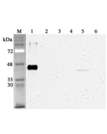 Western blot analysis using anti-Sirtuin 2 (human), mAb (S2R233-1) (Prod. No. AG-20A-0076) at 1:4'000 dilution.<br />1: Human sirtuin 2 (His-tagged).<br />2: Human sirtuin 1 (His-tagged).<br />3: Human sirtuin 5 (His-tagged).<br />4: Human sirtuin 6 (His-