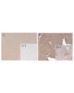 Immunohistochemical staining of mouse FTO using anti-FTO (mouse), mAb (FT62-6) (Prod. No. AG-20A-0083) in mouse tissue (1:500 dilution, 200X).<br />A. Immunoperoxidase staining of formalin-Fixed, paraffin-embedded mouse brain.<br />A-1. Isotype control, m