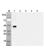 Western blot analysis using anti-Sirtuin 6 (human), mAb (S6R82-2) (Prod. No. AG-20A-0091) at 1:2'000 dilution.<br />1: Human sirtuin 6 (His-tagged).<br />2: Human sirtuin 1 (His-tagged).<br />3: Human sirtuin 2 (His-tagged).<br />4: Human sirtuin 5 (His-t