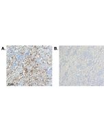 Immunohistochemical staining of CTRP6 using anti-CTRP6 (human), mAb (256-E) (Prod. No. AG-20A-0093) in human tissue.<br /> <b>Method:</b> A. Paraffin-embedded human kidney tissue, showing stained cell cytoplasm using anti-CTRP6 (human), mAb (256-E) at dil