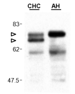 Cardif is cleaved in liver of a patient infected by the hepatitis C virus. 
Protein extracts of liver biopsies from a patient with chronic hepatitis C (CHC) and as a control from a patient with alcoholic hepatitis (AH) were run on a SDS-gel and revealed 