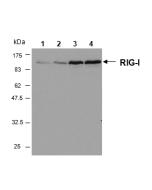 Western blot analysis of human RIG-I in HeLa cells by using RIG-I, mAb (Alme-1) (Prod. No. AG-20B-0009).<br />
<b>Method:</b> Cell extracts from HeLa cells either unstimulated (lane 1) or stimulated for 6h (lane 2), 16h (lane 3) or 24 h (lane 4) with Inte