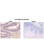 Immunohistochemistry detection of endogenous TRAIL-R3 in paraffin-embedded human carcinoma tissues (colon, tonsil) using mAb to TRAIL-R3 (TR3.06) (Prod. No. AG-20B-0029).