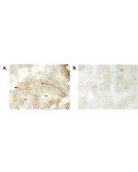 Immunohistochemical staining of bioptic sections of small intestine using anti-NLRP6/NALP6 (human), mAb (Clint-1) (AG-20B-0046) at 1:500 dilution. <b>Method:</b> A) Epithelial tissues which express NLRP6 (positive control) (black arrows) and connective ti