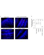<i>In vivo</i> depletion of gut IgA plasma cells by combined inhibition of BAFF and APRIL with the antibodies BAFF (mouse), mAb (blocking) (Sandy-2) (Prod. No. AG-20B-0063PF) and APRIL (mouse), mAb (blocking) (Centotto-1) (Prod. No. AG-20B-0083PF) in mice