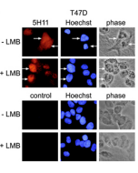 Immunofluorescence using anti-PARP-10 [ARTD10] (human), mAb (5H11). <b>Method:</b> T47D mammary carcinoma cells were stained by indirect immunofluorescence and analysed. Prior to fixation and staining, the cells were treated with or without 50nm leptomyci