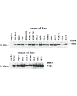 Western blot analysis using anti-caspase-2, mAb (11B4) (Prod. No. AG-20T-0136), detecting caspase-2 expression in cultured mouse and human cell lines. Caspase-2 protein was revealed in lysates from 2x10<sup>5</sup> mouse and human cell lines by 11B4 and E