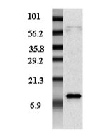 Western blot analysis of adipocyte-conditioned medium from human male and female with different expression levels using anti-Resistin (human), pAb (Biotin) (Prod. No. AG-25A-0013B).