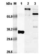 Western blot analysis using anti-RANKL (human), pAb (Prod. No. AG-25A-0016) at 1:5,000 dilution.<br />
1. Recombinant hRANKL (His-tagged).<br />
2. Human RANKL (GST-tagged).>br />
3. Con-A activated human T lymphocytes lysate.