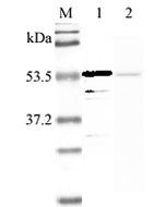 Western blot analysis using anti-Nampt (human), pAb (Prod. No. AG-25A-0025B) at 1:2'000 dilution.<br />
1: Human Nampt (His-tagged).<br />
2: LPS-treated human peripheral blood leukocyte lysate.