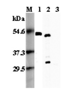 Western blot analysis using anti-FOXP3 (mouse), pAb (Prod. No. AG-25A-0035) at 1:5'000 dilution.<br />
1: Mouse FOXP3 (His-tagged).<br />
2: Transfected mouse FOXP3 cell lysate (HEK 293).<br />
3: Transfected vector only cell lysate.