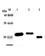 Western blot analysis using anti-RBP4 (rat), pAb (Biotin) (Prod. No. AG-25A-0039B) at 1:2'000 dilution.<br />
1: Rat RBP4 (His-tagged).<br />
2: Rat RBP4 (FLAG<sup>®</sup>-tagged).<br />
2: Rat serum (GK/SIc) (1&mu;l).