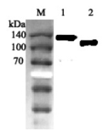 Western blot analysis using anti-ACE2 (human), pAb (Prod. No. AG-25A-0042) at 1:2'000 dilution.<br />
1: Human ACE2 Fc-protein.<br />
2: Human ACE2 (ED) (FLAG<sup>®</sup>-tagged).