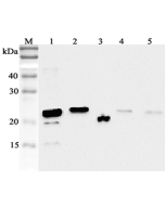 Western blot analysis using anti-RBP4 (human), pAb (Prod. No. AG-25A-0053) at 1:2'000 dilution.<br />
1: Human RBP4 (His-tagged).<br />
2: Human RBP4 (FLAG<sup>®</sup>-tagged).<br />
3: Human serum (2&mu;l).<br />
4: Mouse RBP4 (FLAG<sup>®</sup>-tagged).<