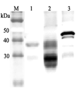 Western blot analysis using anti-Clusterin (mouse), pAb (Prod. No. AG-25A-0054) at 1:2'000 dilution.<br />
1: Mouse serum (2&mu;l).<br />
4: Mouse seminal plasma.<br />
5: Mouse Clusterin (nuclear form) (His-tagged).