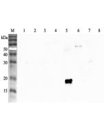 Western blot analysis using anti-ANGPTL4 (human), pAb (Prod. No. AG-25A-0055) at 1:2'000 dilution.<br />
1: Human ANGPTL1 (FLAG<sup>®</sup>-tagged).<br />
2: Human ANGPTL2 (FLAG<sup>®</sup>-tagged).<br />
3: Human ANGPTL3 (FLAG<sup>®</sup>-tagged).<br />
