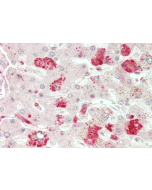 Immunohistochemical staining of ANGPTL3 using anti-ANGPTL3 (CCD) (human), pAb (Prod. No. AG-25A-0060) in human liver tissue (5&micro;g/ml).<br /> This antibody has been tested in immunohistochemistry, analyzed by an anatomic pathologist and validated for 