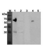 Western blot analysis using anti-ANGPTL3 (mouse), pAb (Prod. No. AG-25A-0070) at 1:2'000 dilution.<br />
1: Mouse ANGPTL3 (FLAG<sup>®</sup>-tagged) (40ng).<br />
2: Mouse liver cell lysate (Balb/c mouse, 150&mu;g).<br />
3: Mouse ANGPTL4 (FLAG<sup>®</sup>