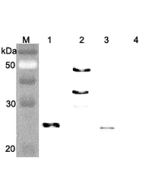 Western blot analysis of human FGF21 using anti-FGF-21 (human), pAb (Prod. No. AG-25A-0074) at 1:4,000 dilution..<br /> 1. Recombinant human FGF21 (FLAG-tagged).<br /> 2. Recombinant human FGF21 (Fc protein).<br /> 3. Recombinant human FGF21 (His-tagged).