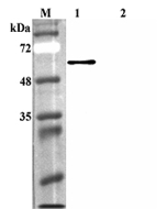 Western blot analysis using anti-FTO (human), pAb (Prod. No. AG-25A-0084) at 1:4'000 dilution.<br />
1: Human FTO (His-tagged).<br />
2: Human Sirtuin 1 (His-tagged) (negative control).