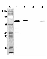 Western blot analysis of mouse FTO using anti-FTO (mouse), pAb (Prod. No. AG-25A-0089) at 1:4,000 dilution.<br /> 1. Recombinant mouse FTO (His-tagged) (100ng).<br /> 2. Recombinant human FTO (His-tagged) (100ng).<br /> 3. Recombinant hFGF19 (His-tagged) 