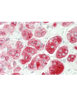 Immunohistochemical staining of DLK1 using anti-DLK1 (human), pAb (Prod. No. AG-25A-0092) in human adrenal tissue (5&micro;g/ml).<br /> This antibody has been tested in immunohistochemistry, analyzed by an anatomic pathologist and validated for use in IHC