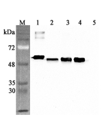 Western blot analysis using anti-Calreticulin (human), pAb (Prod. No. AG-25A-0094) at 1:4'000 dilution.<br />
1: Human Calreticulin (his-tagged).<br />
2: HEK 293T cell lysate (100&mu;g).<br />
3: HepG2 cell lysate (100&mu;g).<br />
4: THP1 cell lysate (1