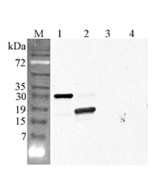 Western blot analysis using anti-CTRP5 (GD) (human), pAb (Prod. No. AG-25A-0096) at 1:4'000 dilution.<br />
1: Human CTRP5 (His-tagged).<br />
2: Human CTRP5 (GD) (His-tagged).<br />
3: Mouse FTO (His-tagged) (negative control).<br />
4: Human CTRP6 (His-