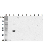 Western blot analysis using anti-CTRP5 (human), pAb (Prod. No. AG-25A-0103) at 1:5'000 dilution.<br />
1: Human CTRP5 (tGD) (His-tagged).<br />
2: Human CTRP5 (His-tagged).<br />
3: Human CTRP5 (GD) (His-tagged) (negative control).<br />
4: Human CTRP6 (H