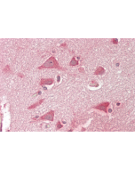 Immunohistochemical staining of NMNAT2 using anti-NMNAT2 (human), pAb (Prod. No. AG-25A-0113) in human brain cortex tissue (15&micro;g/ml).<br /> This antibody has been tested in immunohistochemistry, analyzed by an anatomic pathologist and validated for 