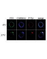 Immunocytochemistry analysis of CARMA1 using anti-CARMA1, pAb (AL220) (Prod. No. AG-25B-0004V). <br /> <strong>Method:</strong> Human T cells (clone 6396p5.1.2) were incubated with anti-CD3, mAb for 20 min. on ice, followed by incubation with secondary go