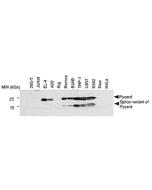 Western blot analysis of human and mouse cell lines using anti-Asc, pAb (AL177) (Prod. No. AG-25B-0006). <br />
Total protein extracts from various human (293-T, Jurkat, Raj, Ramos, BJAB, THP-1, U937, K562, Raw, HeLa) and mouse (EL-4, A20) cell lines wer