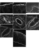 Immunohistochemistry detection of human cornulin using anti-Cornulin (human), pAb (SZ1229) (Prod. No. AG-25B-0016). <strong>Method:</strong> Staining performed on frozen sections of esophagus (H), foreskin (A-C) and scalp (D-G) using anti-Cornulin (human)