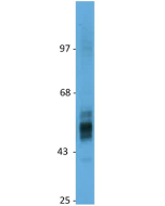 anti-GLUT2 (human), pAb (IN117)