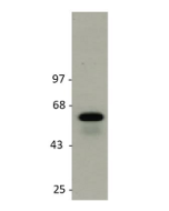 anti-GLUT2 (rat), pAb (IN119)