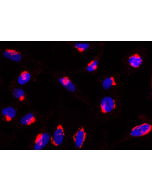 Rab6-GTP is detected by immunocytochemistry using anti-Rab6-GTP, mAb (AA2) (Prod. No. AG-27B-0004).<br /> <strong>Method:</strong> HeLa cells are grown in standard culture conditions, fixed with paraformaldehyde (3%), permeablized in  PBS+ BSA 0.2 % + Sap