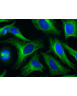 Human alpha-Tubulin is detected by immunocytochemistry using anti-alpha-Tubulin, mAb (rec.) (F2C) (ATTO 488) (Prod. No. AG-27B-0005TD). <br /><b>Method:</b> HeLa cells are grown in standard culture conditions, fixed with methanol, and incubated with anti-