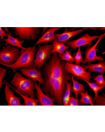 Human &beta;-Tubulin is detected by immunocytochemistry using anti-&beta;-Tubulin, mAb (rec.) (S11B) (Prod. No. AG-27B-0008). <br /><strong>Method:</strong> HeLa cells are grown in standard culture conditions, fixed with methanol, and incubated with anti-