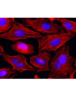 Human Myosin IIA (non-muscle) (heavy chain) is detected by immunocytochemistry using anti-myosin IIA (non-muscle) (rec.) (SF9) (Prod. No. AG-27B-0010). <br /><b>Method:</b> HeLa cells are grown in standard culture conditions, fixed with methanol, and incu