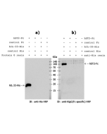 Pull down assay:<br />
a) pull down of hIL-33-His by hST2-Fc<br />
b) pull down of hST2-Fc by hIL-33-His<br />
5&mu;g of hST2-Fc (or control Fc protein), 2&mu;g of hIL-33-His (Prod. No. AG-40A-0042) (or control His protein), and protein G resin (or anti-H