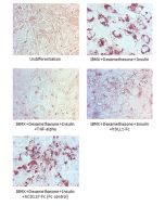 Adipogenesis inhibition of 3T3L1 cells.<br />3T3L1 cells were maintained in DMEM, supplemented with 10% fetal bovine serum, penicilin-streptomycin. Adipogenesis was initiated by adding 1&mu;M dexamethasone, 0.5mM IBMX, 10&mu;g/ml insulin (day 0) until day