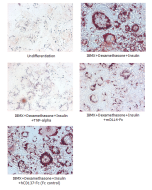 Adipogenesis inhibition of 3T3L1 cells.<br /> 3T3L1 cells were maintained in DMEM, supplemented with 10% fetal bovine serum, penicilin-streptomycin. Adipogenesis was initiated by adding 1&mu;M Dexamethasone, 0.5mM IBMX, 10&mu;g/m lnsulin (day 0) until day