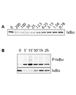 IL-1&beta; (human) (rec.) (untagged)